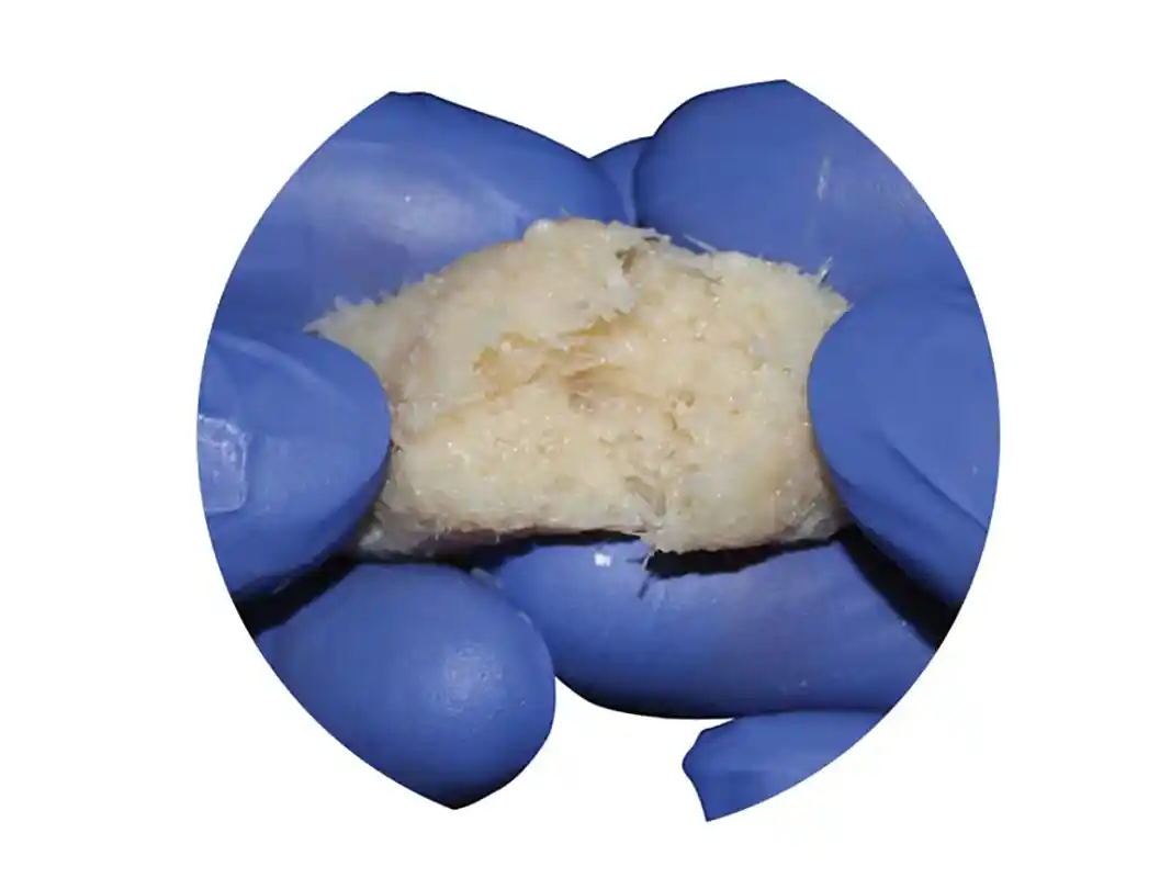 Moldable Viable Bone Matrix